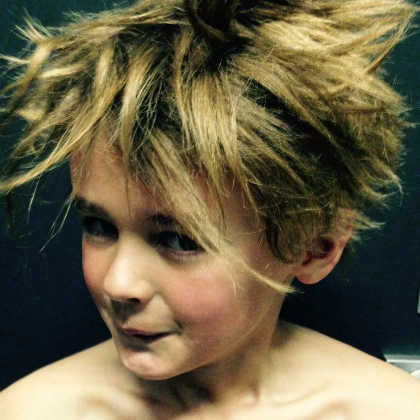 oske