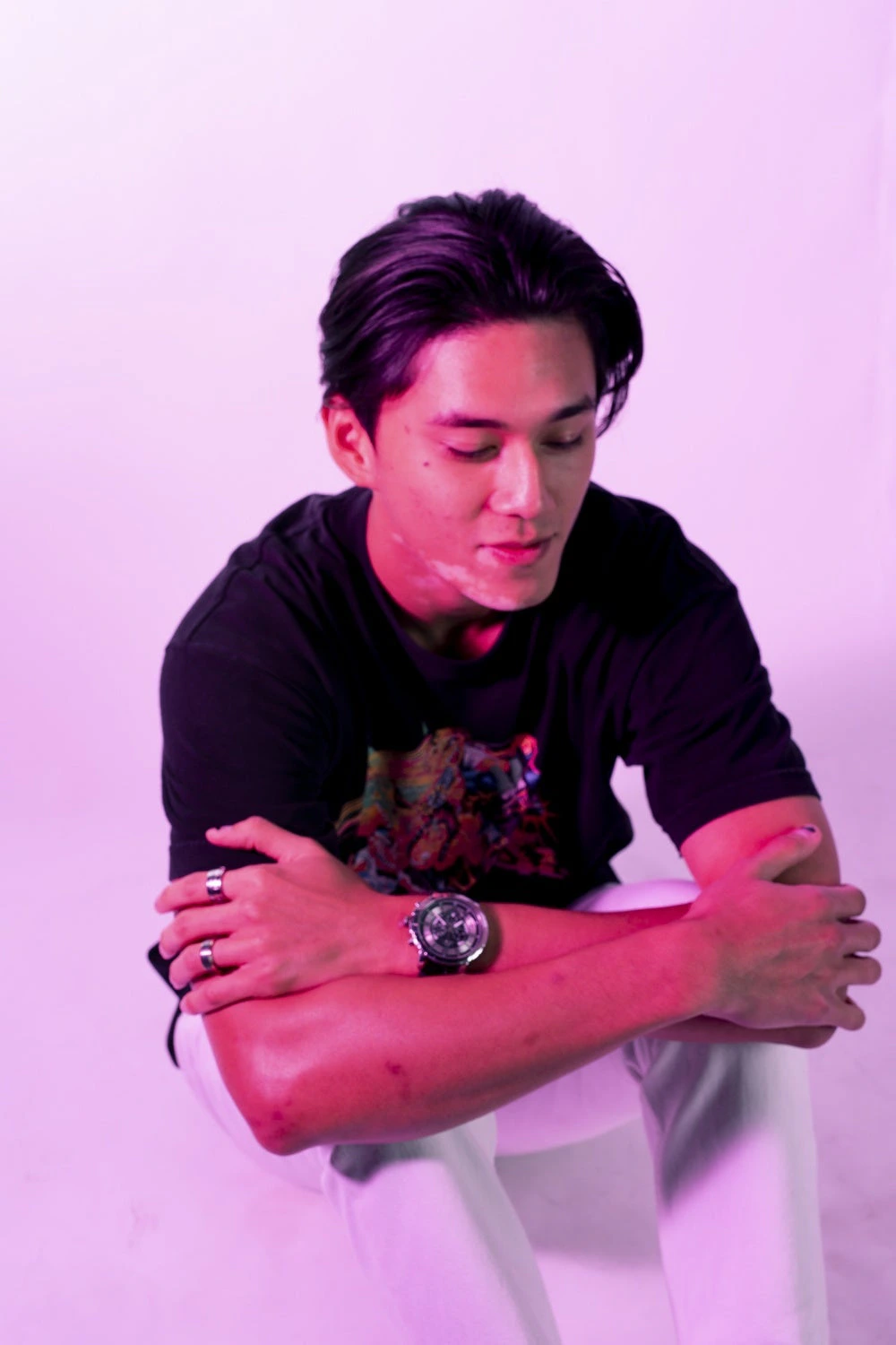 ANH