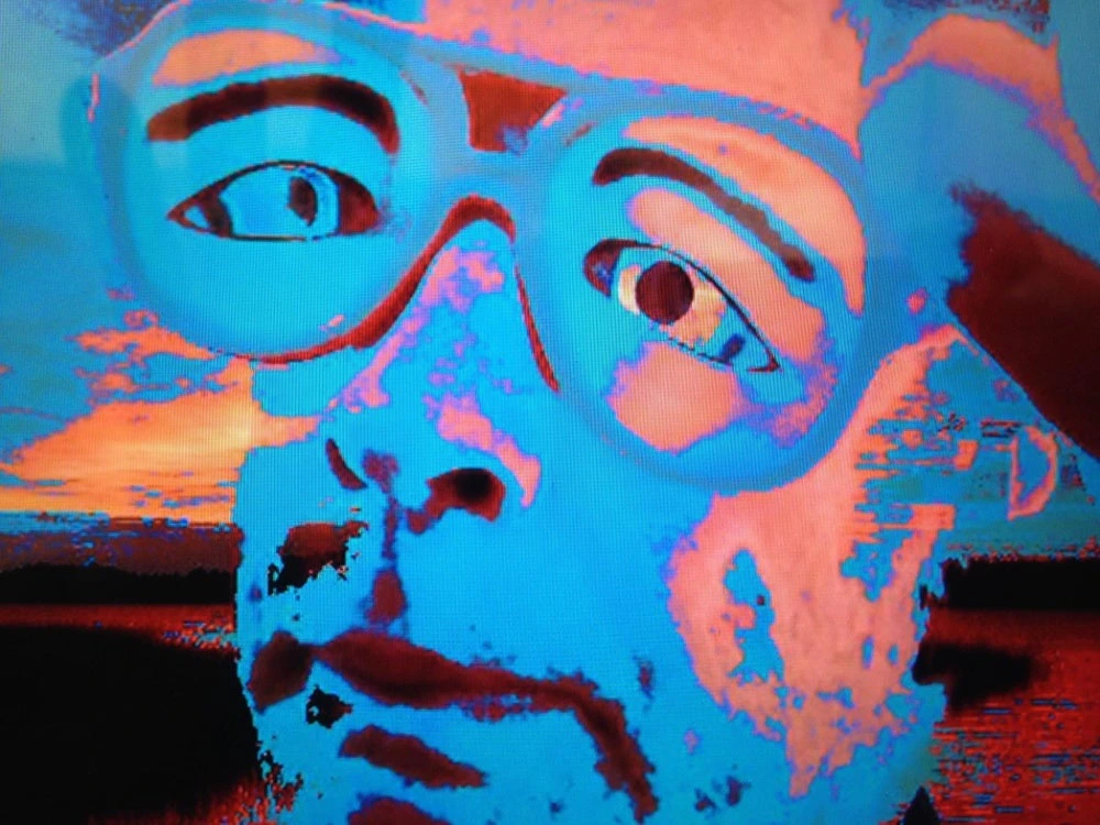 XrayZed