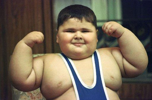 DJ - OBESITY