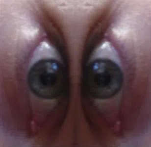 ODDFOOT