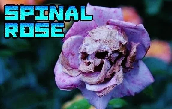 Spinal Rose