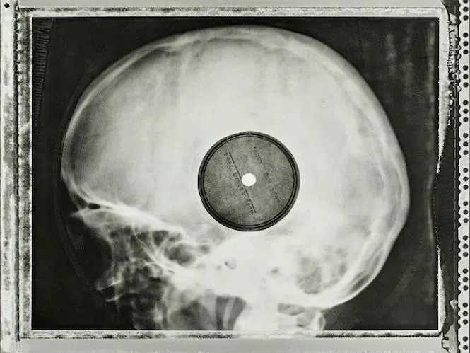 Soviet Rock 'n Roll X-Ray Vinyl