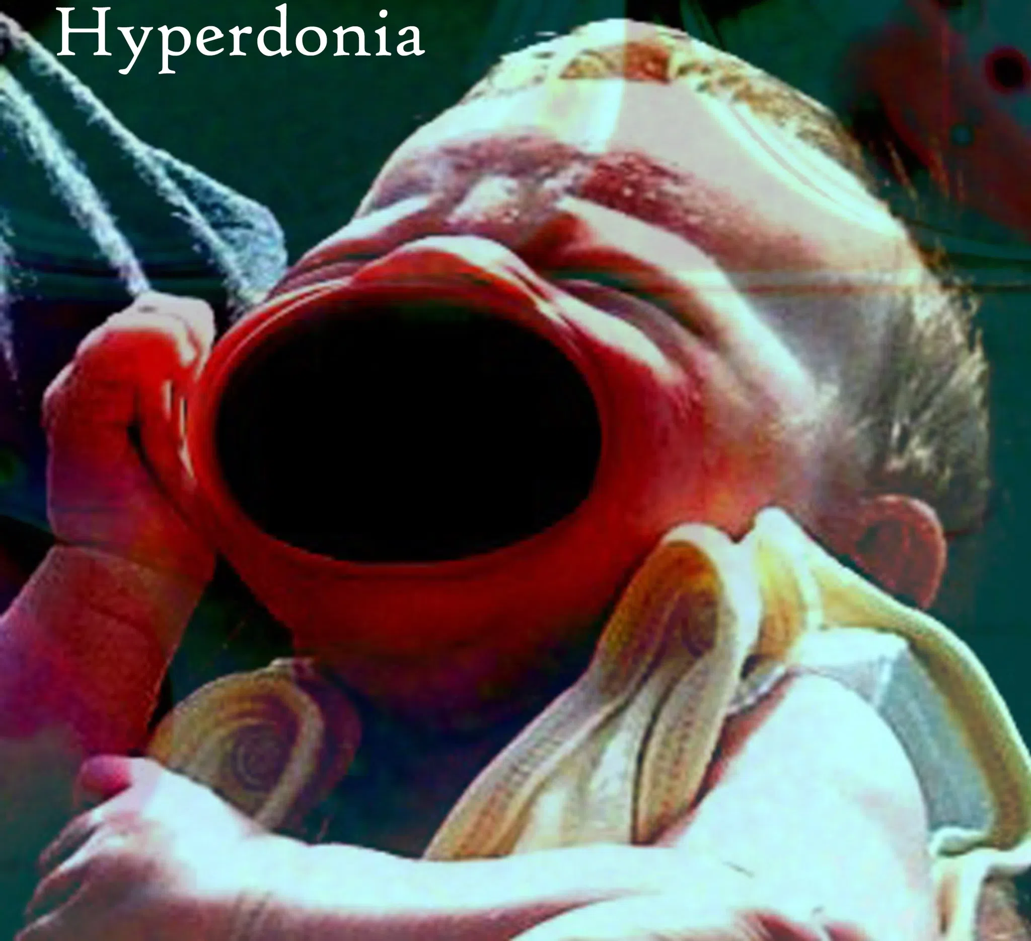 Hyperdonia
