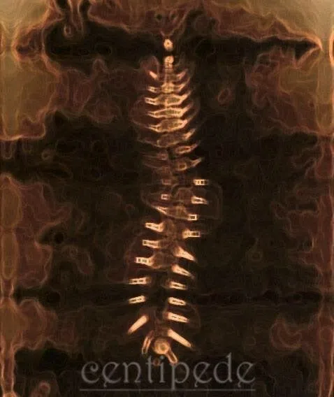 centipede