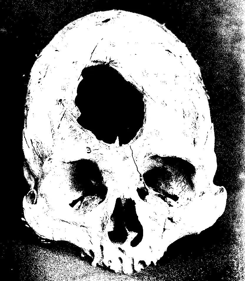Mass Grave